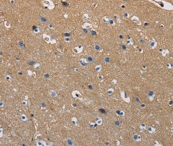 Immunohistochemical analysis of paraffin-embedded Human brain tissue using #36220 at dilution 1/50.