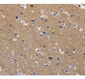 Immunohistochemistry - GSTA2 Antibody from Signalway Antibody (36220) - Antibodies.com