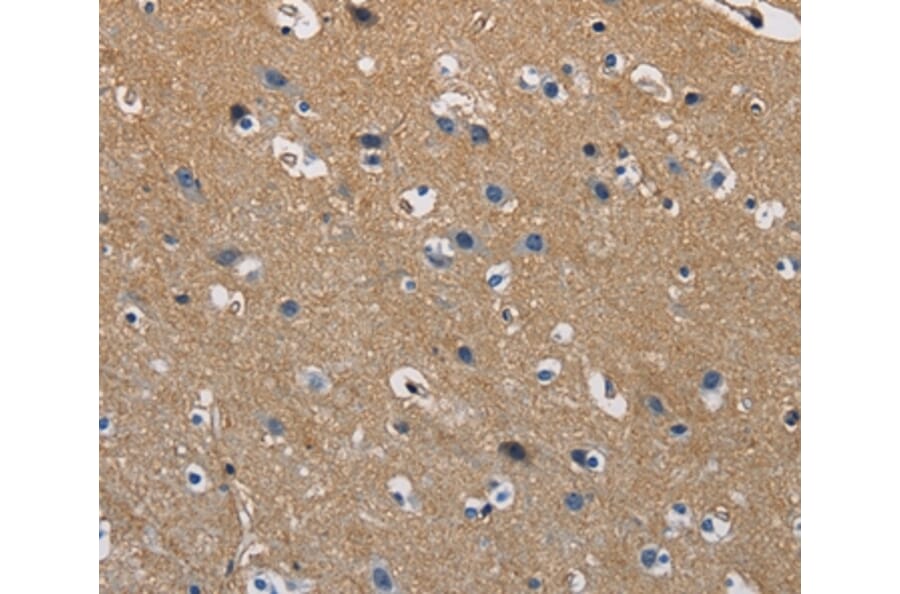 Immunohistochemistry - GSTA2 Antibody from Signalway Antibody (36220) - Antibodies.com