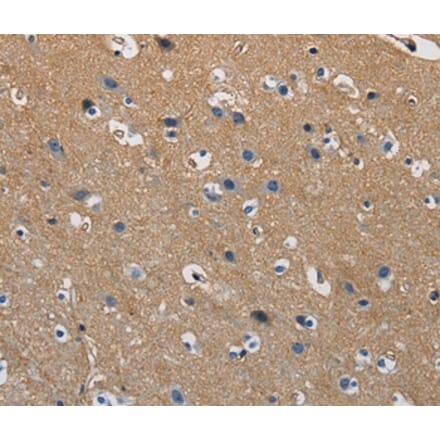 Immunohistochemistry - GSTA2 Antibody from Signalway Antibody (36220) - Antibodies.com