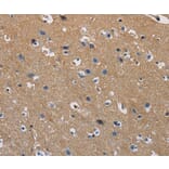 Immunohistochemistry - GSTA2 Antibody from Signalway Antibody (36220) - Antibodies.com