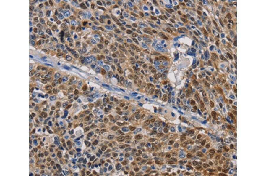 Immunohistochemistry - GSTA2 Antibody from Signalway Antibody (36220) - Antibodies.com