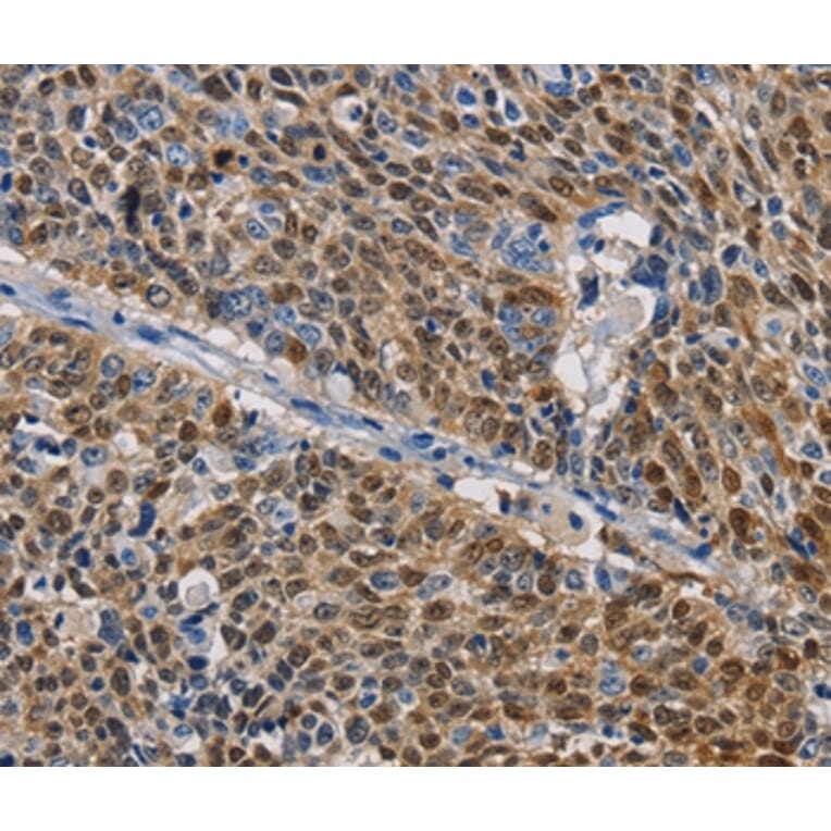 Immunohistochemistry - GSTA2 Antibody from Signalway Antibody (36220) - Antibodies.com