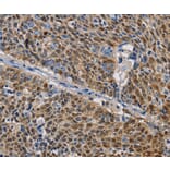 Immunohistochemistry - GSTA2 Antibody from Signalway Antibody (36220) - Antibodies.com