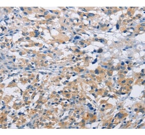 Immunohistochemistry - MTMR4 Antibody from Signalway Antibody (36229) - Antibodies.com