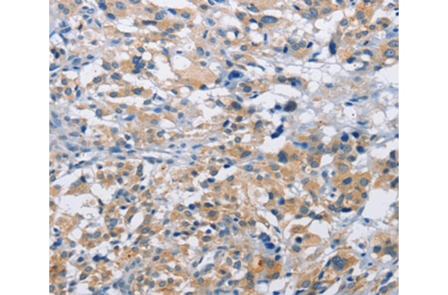 Immunohistochemistry - MTMR4 Antibody from Signalway Antibody (36229) - Antibodies.com