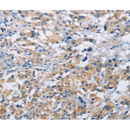 Immunohistochemistry - MTMR4 Antibody from Signalway Antibody (36229) - Antibodies.com