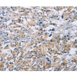 Immunohistochemistry - MTMR4 Antibody from Signalway Antibody (36229) - Antibodies.com