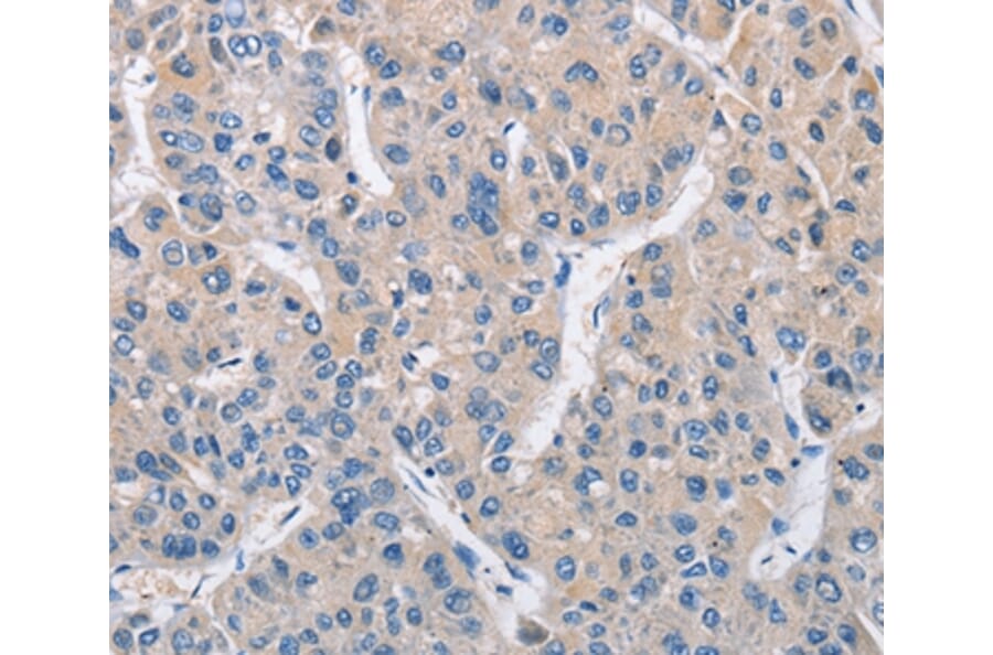 Immunohistochemistry - MTMR4 Antibody from Signalway Antibody (36229) - Antibodies.com