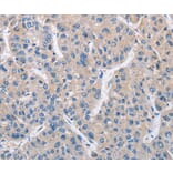 Immunohistochemistry - MTMR4 Antibody from Signalway Antibody (36229) - Antibodies.com