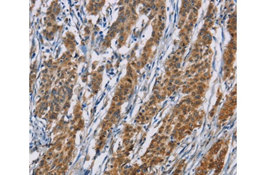 Immunohistochemistry - ACVR1 Antibody from Signalway Antibody (36233) - Antibodies.com