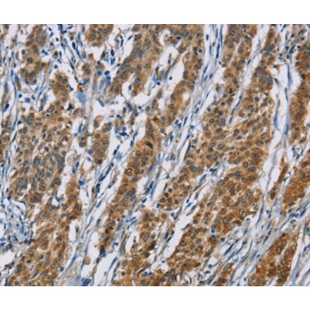 Immunohistochemistry - ACVR1 Antibody from Signalway Antibody (36233) - Antibodies.com