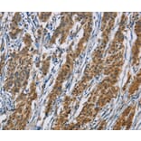 Immunohistochemistry - ACVR1 Antibody from Signalway Antibody (36233) - Antibodies.com