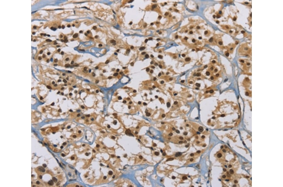 Immunohistochemistry - ACVR1 Antibody from Signalway Antibody (36233) - Antibodies.com