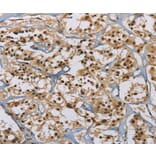 Immunohistochemistry - ACVR1 Antibody from Signalway Antibody (36233) - Antibodies.com