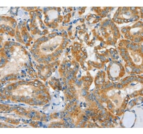 Immunohistochemistry - ASCC1 Antibody from Signalway Antibody (36243) - Antibodies.com