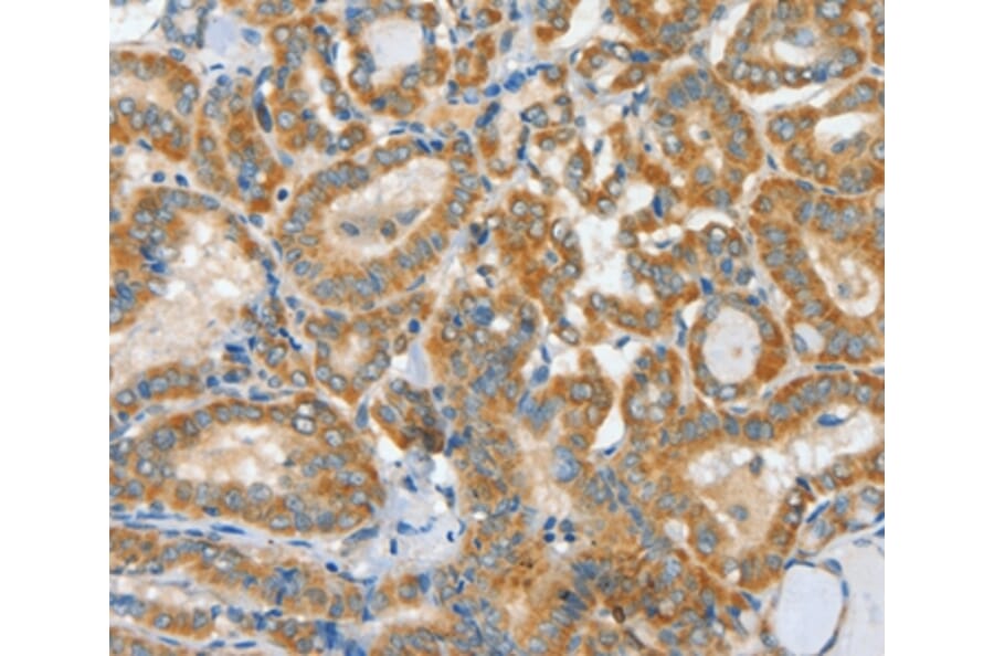 Immunohistochemistry - ASCC1 Antibody from Signalway Antibody (36243) - Antibodies.com