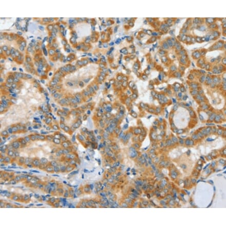 Immunohistochemistry - ASCC1 Antibody from Signalway Antibody (36243) - Antibodies.com