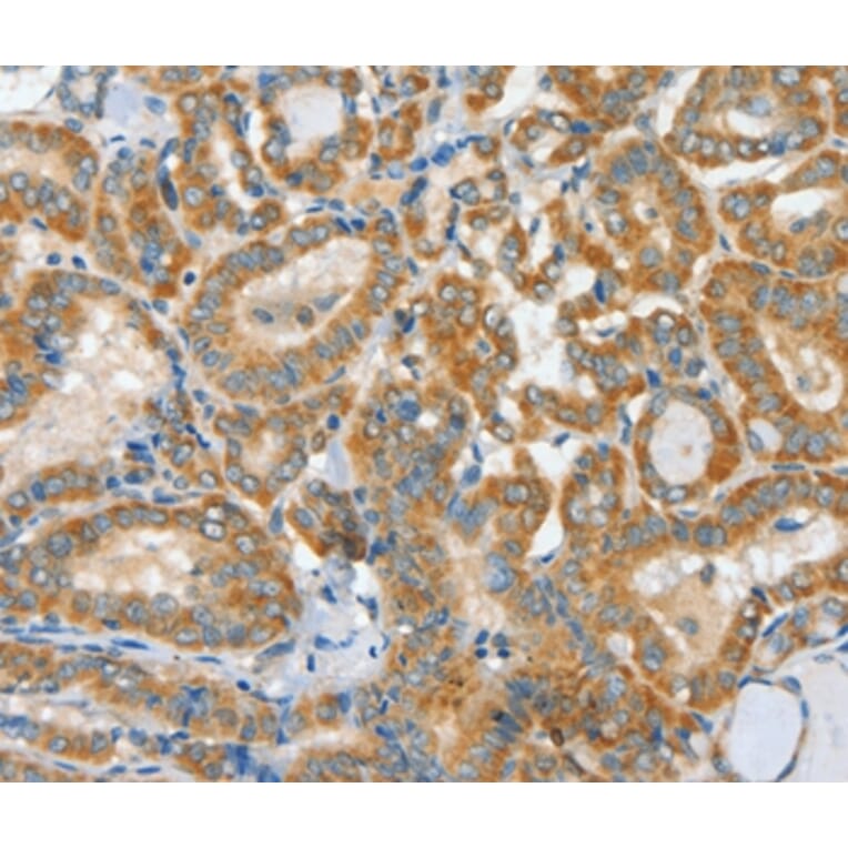 Immunohistochemistry - ASCC1 Antibody from Signalway Antibody (36243) - Antibodies.com