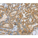 Immunohistochemistry - ASCC1 Antibody from Signalway Antibody (36243) - Antibodies.com