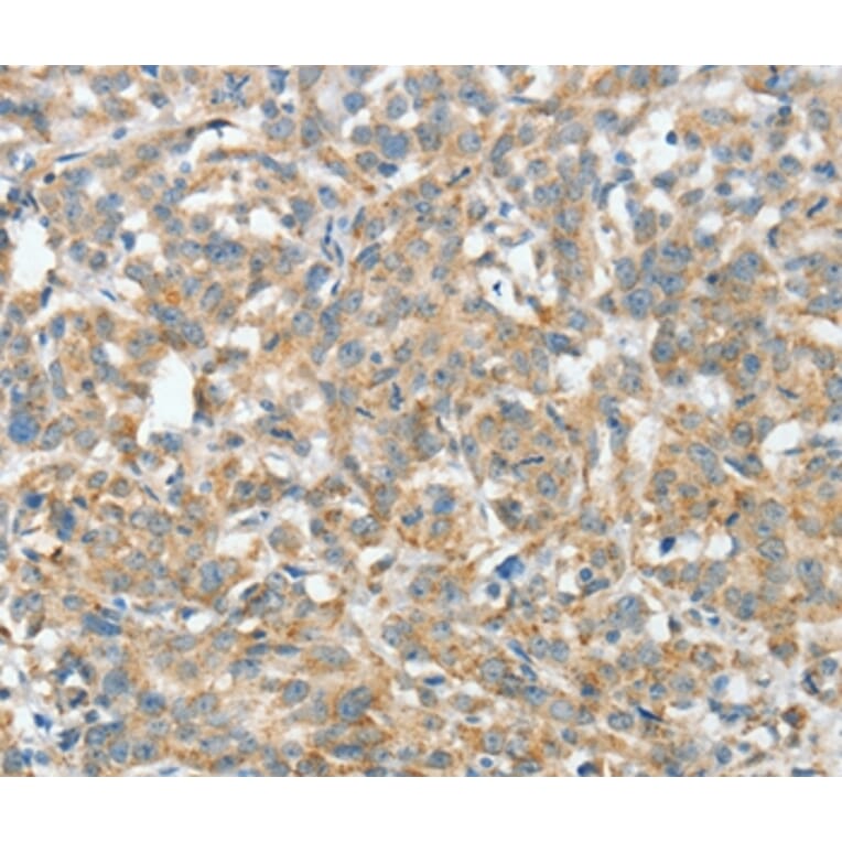 Immunohistochemistry - ASCC1 Antibody from Signalway Antibody (36243) - Antibodies.com