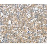 Immunohistochemistry - ASCC1 Antibody from Signalway Antibody (36243) - Antibodies.com