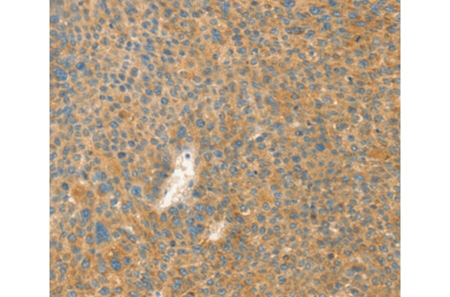 Immunohistochemistry - AANAT Antibody from Signalway Antibody (36248) - Antibodies.com