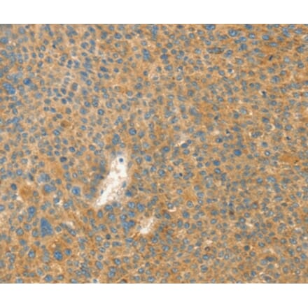 Immunohistochemistry - AANAT Antibody from Signalway Antibody (36248) - Antibodies.com
