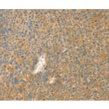 Immunohistochemistry - AANAT Antibody from Signalway Antibody (36248) - Antibodies.com