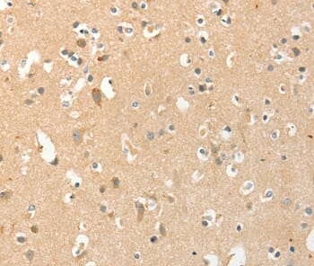 Immunohistochemical analysis of paraffin-embedded Human brain tissue using #36248 at dilution 1/40.