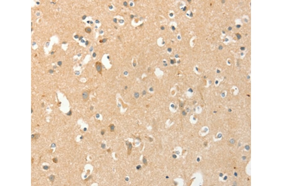 Immunohistochemistry - AANAT Antibody from Signalway Antibody (36248) - Antibodies.com