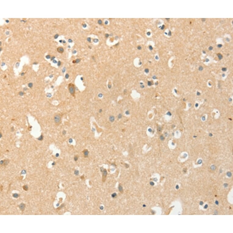 Immunohistochemistry - AANAT Antibody from Signalway Antibody (36248) - Antibodies.com