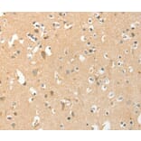 Immunohistochemistry - AANAT Antibody from Signalway Antibody (36248) - Antibodies.com