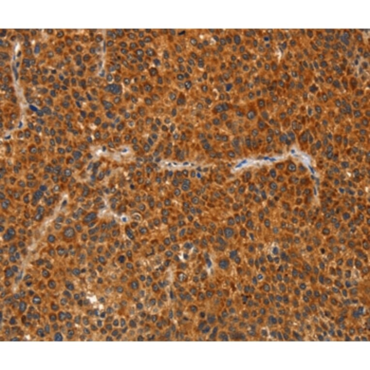 Immunohistochemistry - IKZF3 Antibody from Signalway Antibody (36254) - Antibodies.com