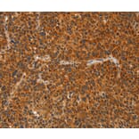 Immunohistochemistry - IKZF3 Antibody from Signalway Antibody (36254) - Antibodies.com