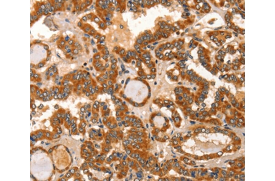 Immunohistochemistry - IKZF3 Antibody from Signalway Antibody (36254) - Antibodies.com