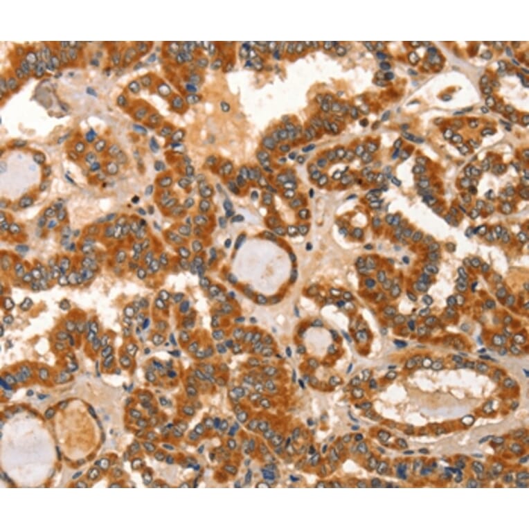 Immunohistochemistry - IKZF3 Antibody from Signalway Antibody (36254) - Antibodies.com
