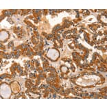 Immunohistochemistry - IKZF3 Antibody from Signalway Antibody (36254) - Antibodies.com