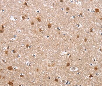 Immunohistochemical analysis of paraffin-embedded Human brain tissue using #36257 at dilution 1/40.