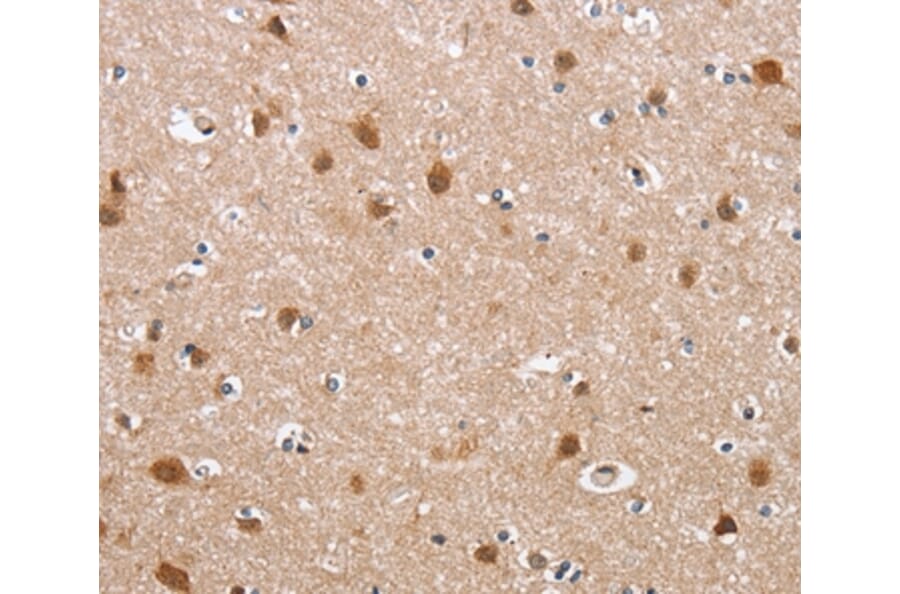 Immunohistochemistry - DEFA6 Antibody from Signalway Antibody (36257) - Antibodies.com