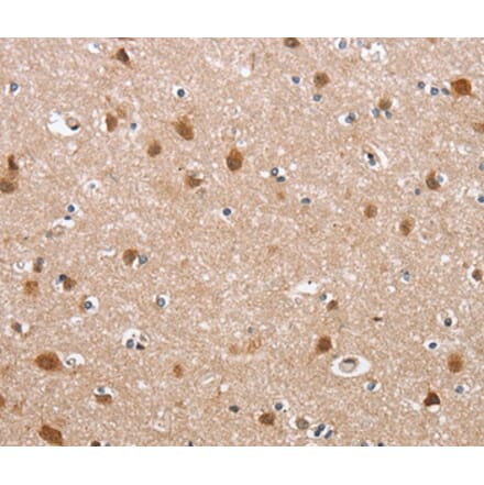 Immunohistochemistry - DEFA6 Antibody from Signalway Antibody (36257) - Antibodies.com