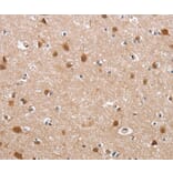 Immunohistochemistry - DEFA6 Antibody from Signalway Antibody (36257) - Antibodies.com