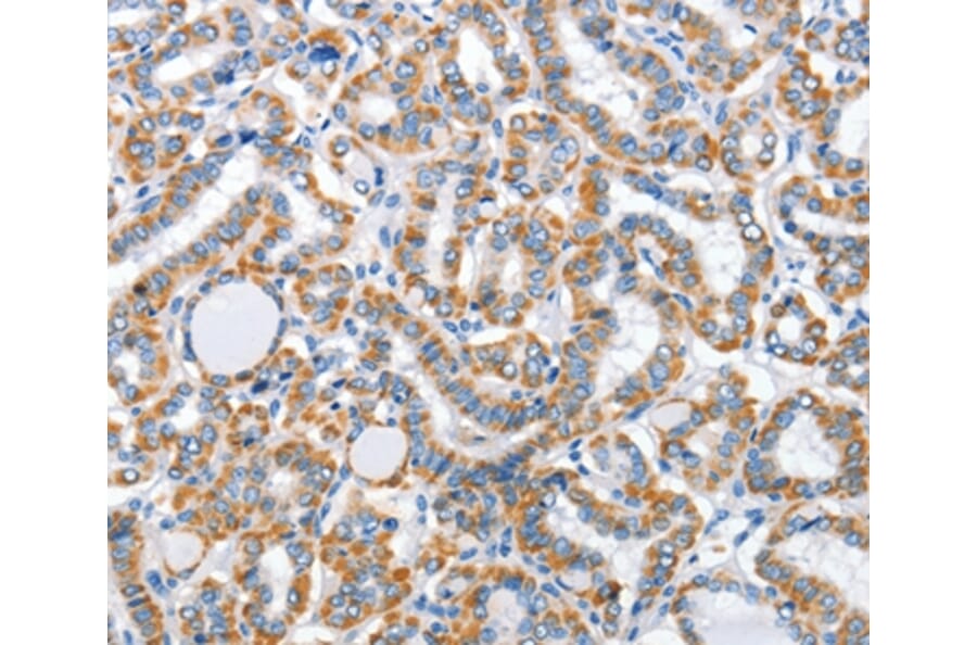 Immunohistochemistry - ARL11 Antibody from Signalway Antibody (36261) - Antibodies.com