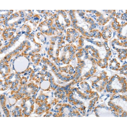 Immunohistochemistry - ARL11 Antibody from Signalway Antibody (36261) - Antibodies.com