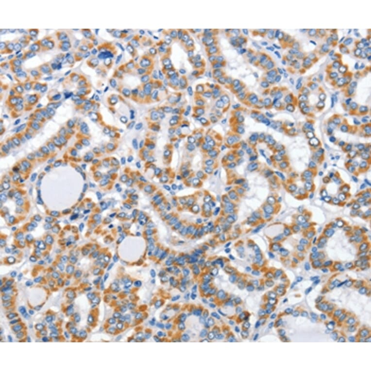 Immunohistochemistry - ARL11 Antibody from Signalway Antibody (36261) - Antibodies.com