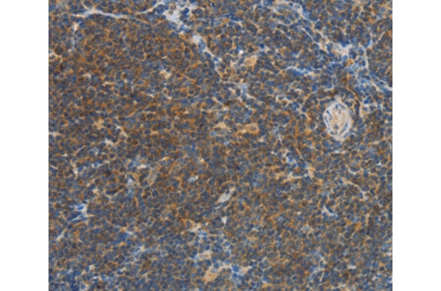 Immunohistochemistry - VTCN1 Antibody from Signalway Antibody (36273) - Antibodies.com