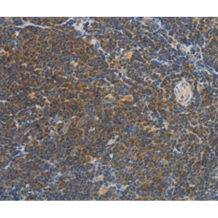 Immunohistochemistry - VTCN1 Antibody from Signalway Antibody (36273) - Antibodies.com