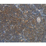 Immunohistochemistry - VTCN1 Antibody from Signalway Antibody (36273) - Antibodies.com