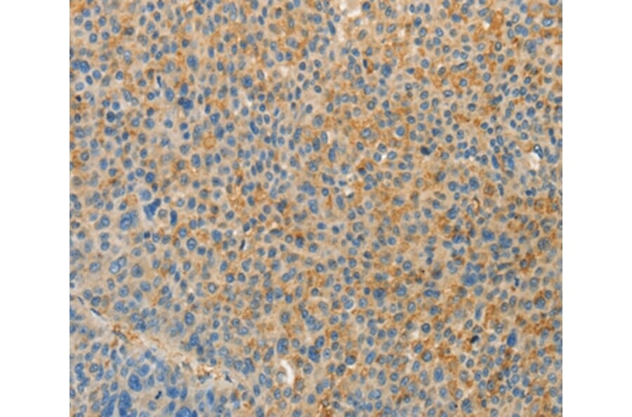 Immunohistochemistry - VTCN1 Antibody from Signalway Antibody (36273) - Antibodies.com