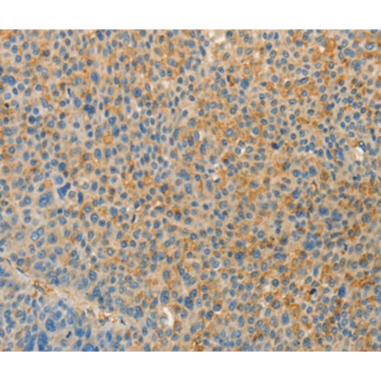 Immunohistochemistry - VTCN1 Antibody from Signalway Antibody (36273) - Antibodies.com